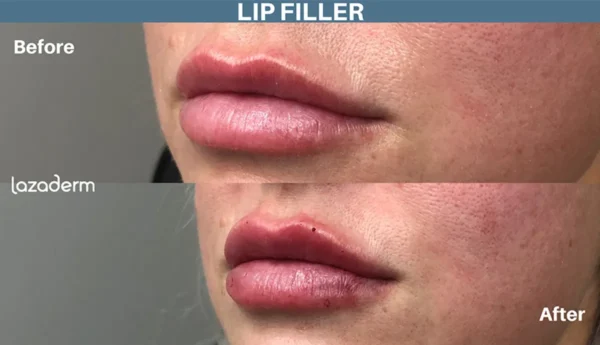 Kissable Lips Package - Image 3