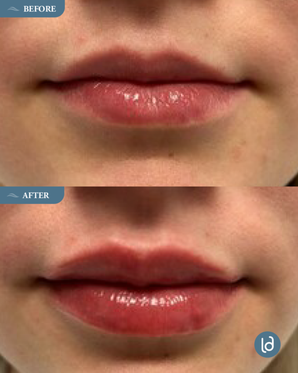 Kissable Lips Package - Image 2