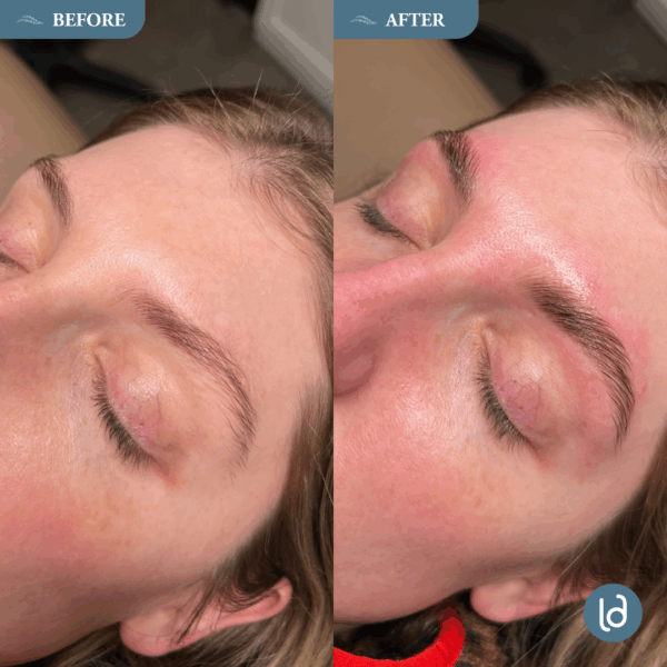 Brow Services